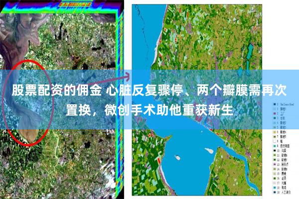 股票配资的佣金 心脏反复骤停、两个瓣膜需再次置换，微创手术助他重获新生